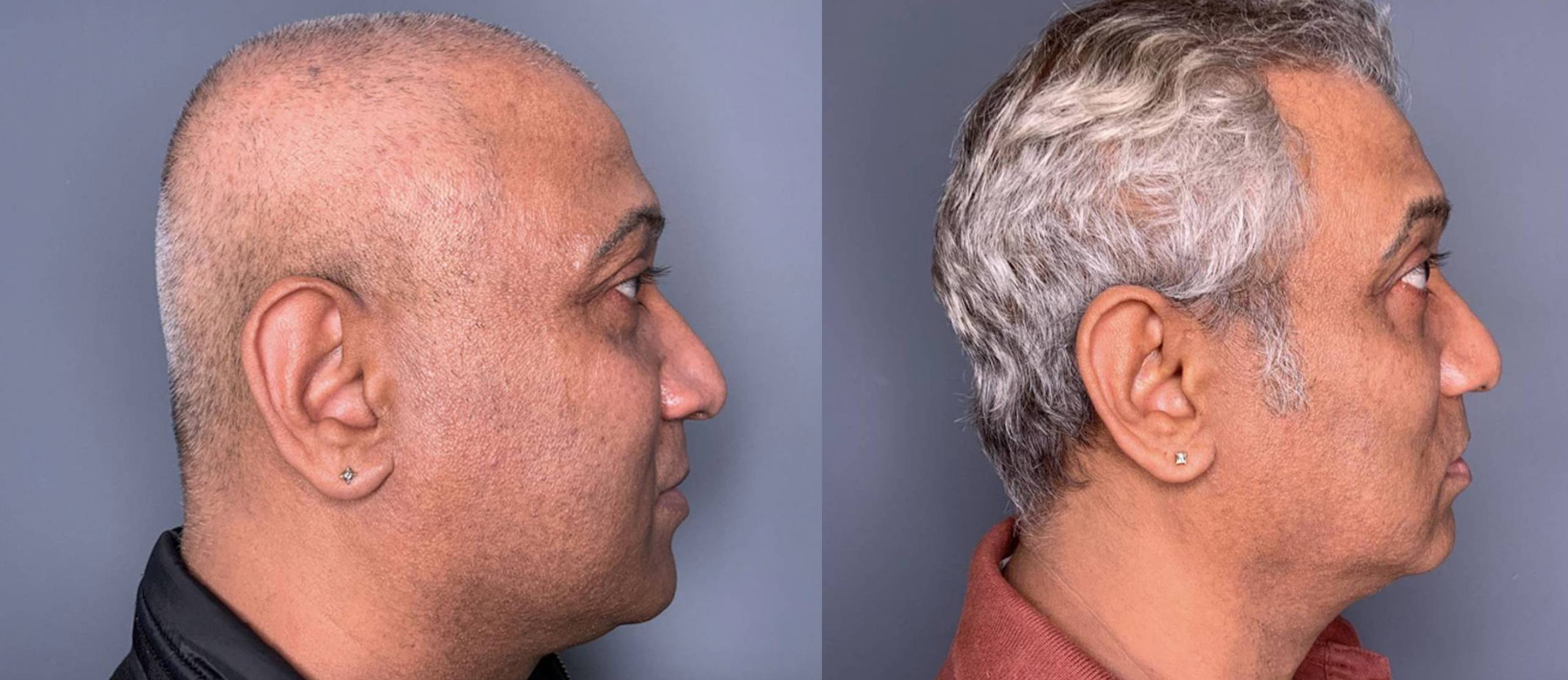 Tone, Texture & Hyperpigmentation - Skin Care Aesthetics in Baytown, TX Tone, Texture & Hyperpigmentation - Skin Care Aesthetics in Baytown, TX